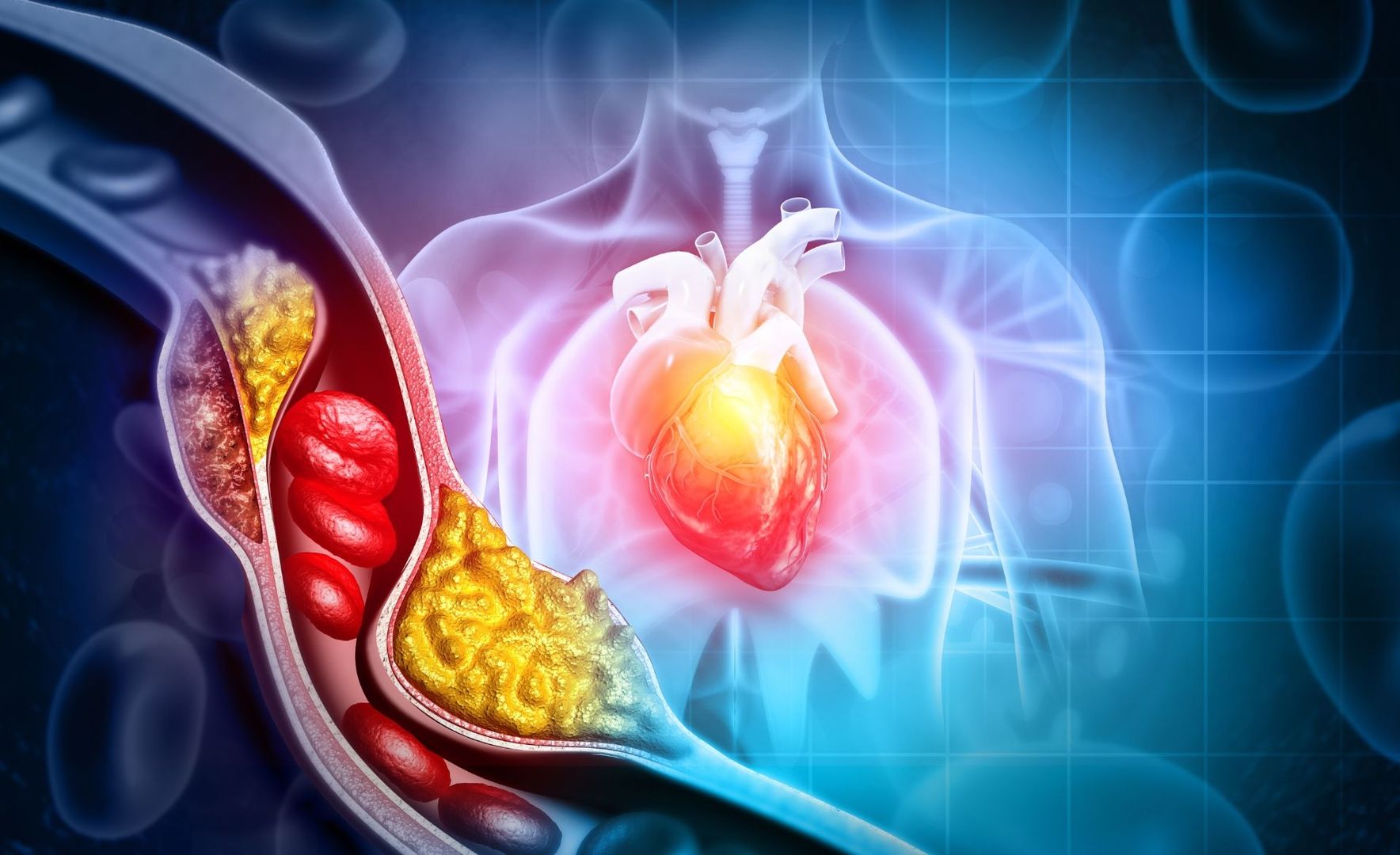 Grafische Darstellung von verstopften Arterien mit Plaquebildung und rotem Herz im Brustkorb - Symbolbild für Arteriosklerose Durchblutungsstörungen und Herz-Kreislauf-Erkrankungen