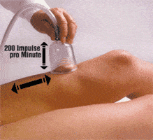 original-schroepftherapie